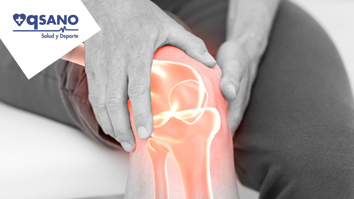 Artrosis de rodilla